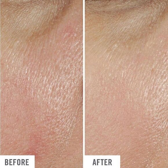 FIRST AID BEAUTY 5 IN 1 EYE CREAM
Smooth, Brighten, Hydrate, Correct & Protect - Picture 3 of 4